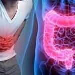enfermedades-intestinales-diariojuridico