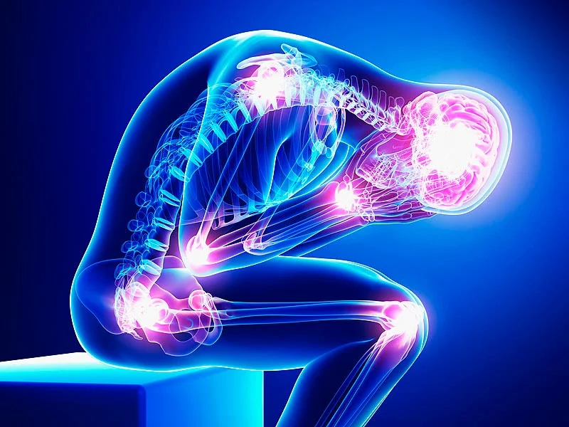 fibromialgia
