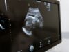 Chile – Proyecto anti aborto