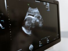 Chile – Proyecto anti aborto Chile – Proyecto anti aborto