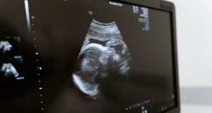Chile – Proyecto anti aborto
