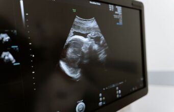 Chile – Proyecto anti aborto Chile – Proyecto anti aborto